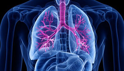 什么是慢性阻塞性肺病 (Chronic Obstructive Pulmonary Disease)，為何與新冠疫情有關(guān)？